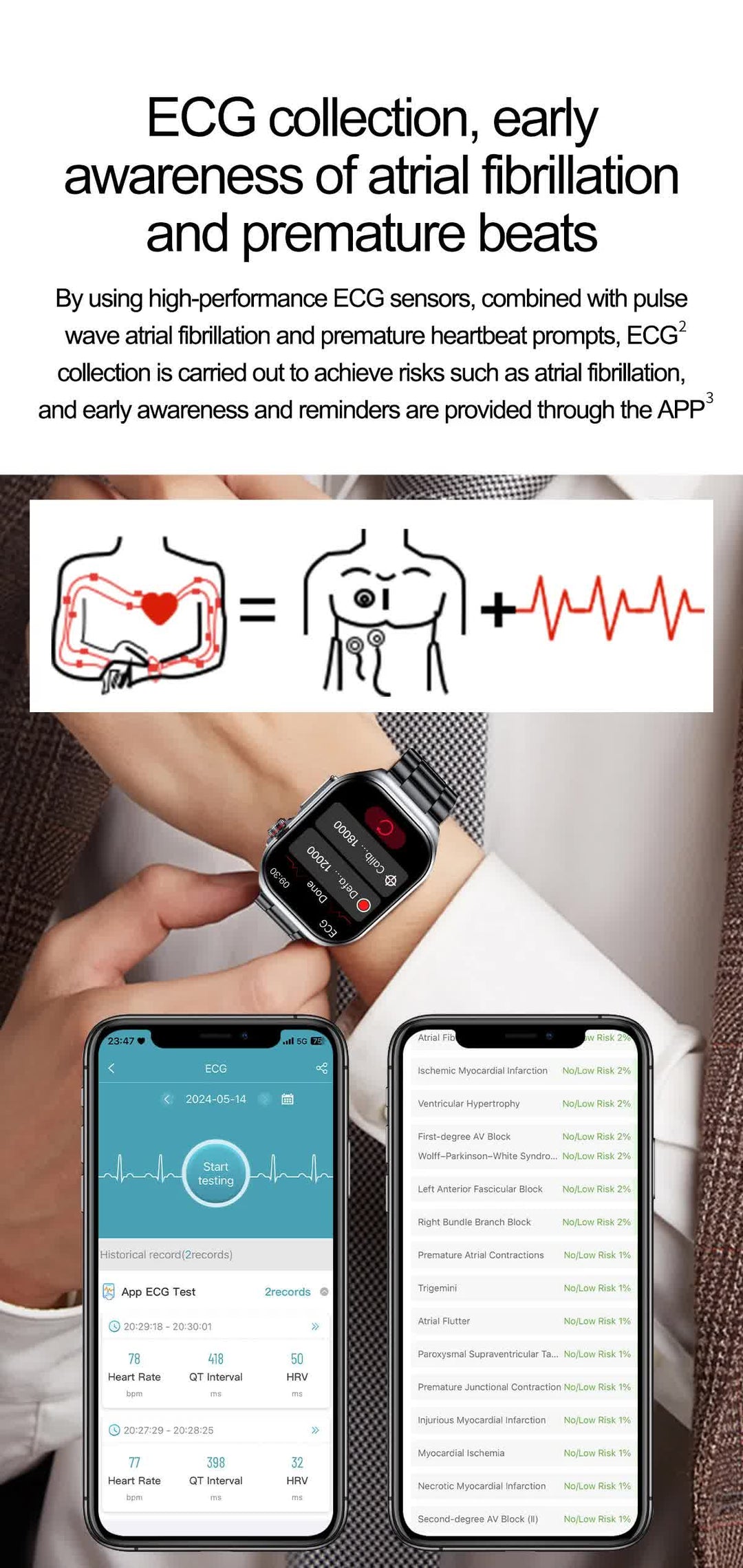 Black Smartwatch with Bluetooth Calling, ECG, Blood Pressure, Heart Rate, and Multi-Sport Modes