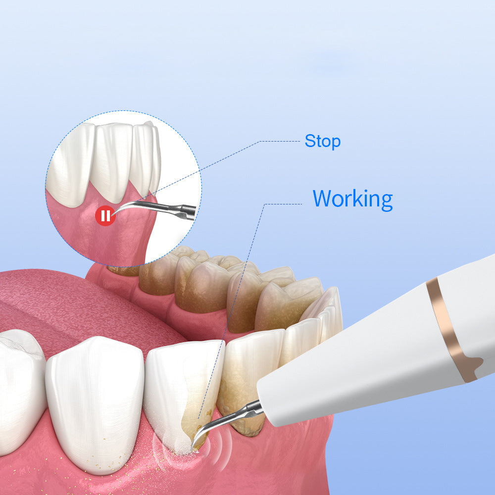 3-Speed Ultrasonic Electric Dental Cleaner with LED Light and Type-C Charging - Professional Plaque Remover Kit